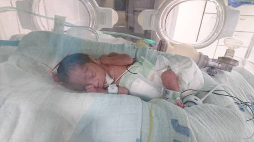 מרגש: תושבת העיר שנולדה פגה ילדה פגה בבית החולים